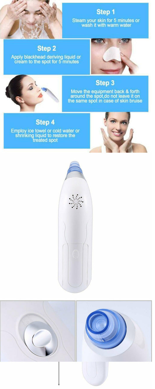 Electric Blackhead Pore Vacuum