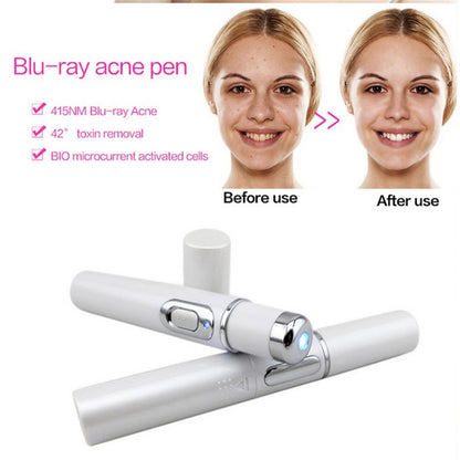 Blue Light Acne Laser Pen