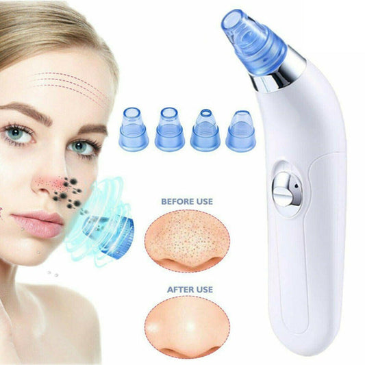 Electric Blackhead Pore Vacuum