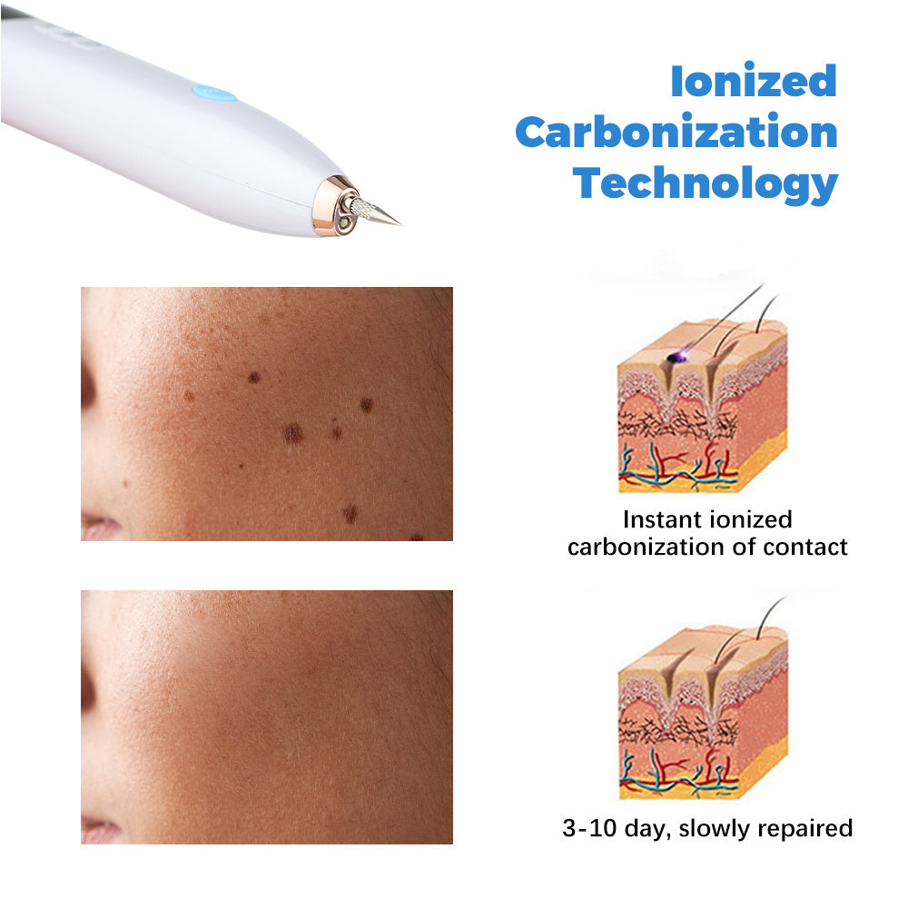 Plasma Pen Skin Tag Remover