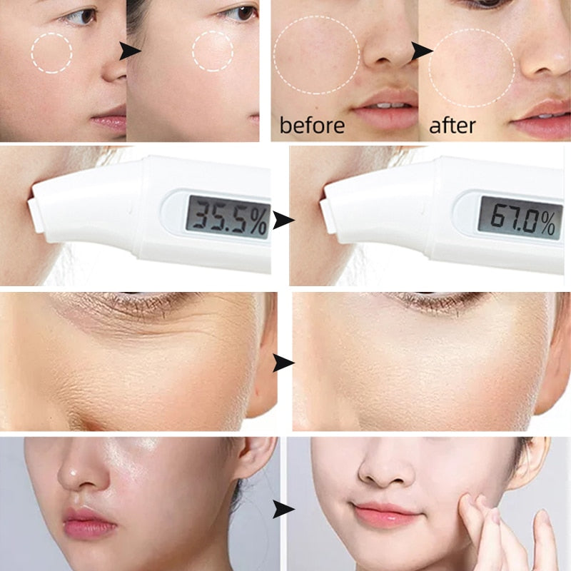SPA Hydro Jelly Mask Powder Hyaluronic Acid Rubber Petal Rose Peel Off Modeling Moisturizing Facial Mask for Dry Skin Care 650G