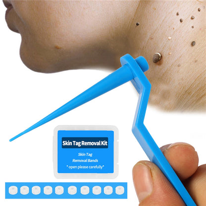 Papilloma Skin Tag Mole Wart Remover Kit Micro Skin Tag Removal Device with Band Rubber Rings for Adult Mole Wart Face Care Tool