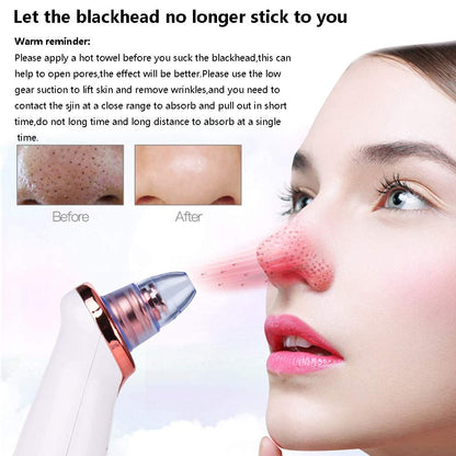 Electric Blackhead Vacuum Suction Cleaner