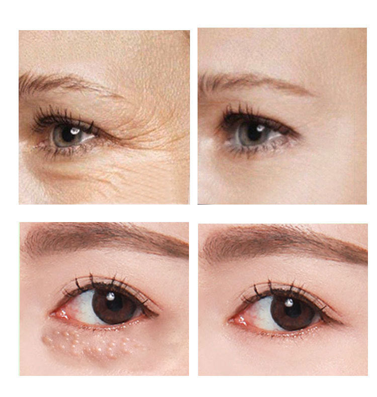 Eye Cream for Women, 30ml